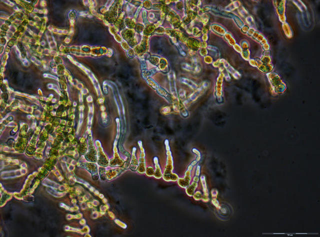 Las bacterias pueden tener cromosomas lineales.