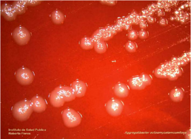 se secuencia el genoma de la bacteria Haemophilus influenzae
