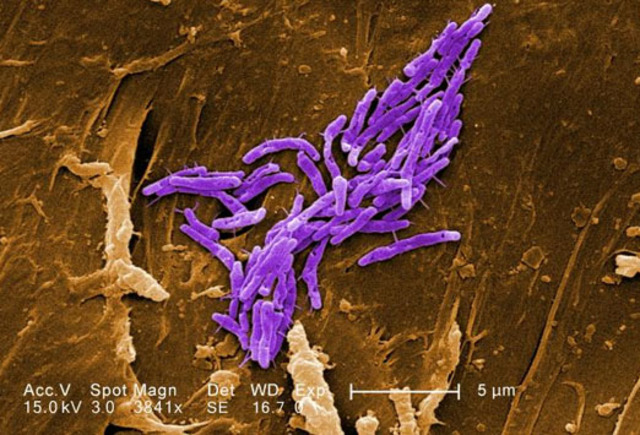 se descubre el proceso de esporulación en Mycobacterium