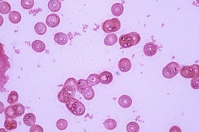 Haemophilus influenzae.