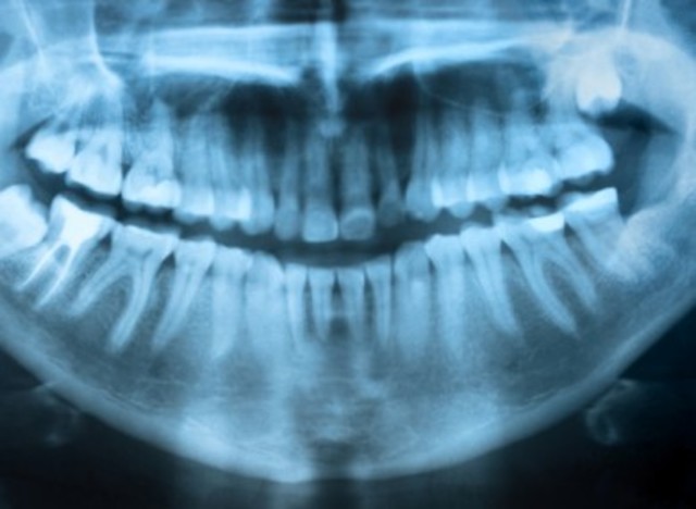 Using Dental Records