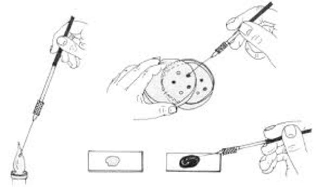 Desarrollo de la tinción de Gram.