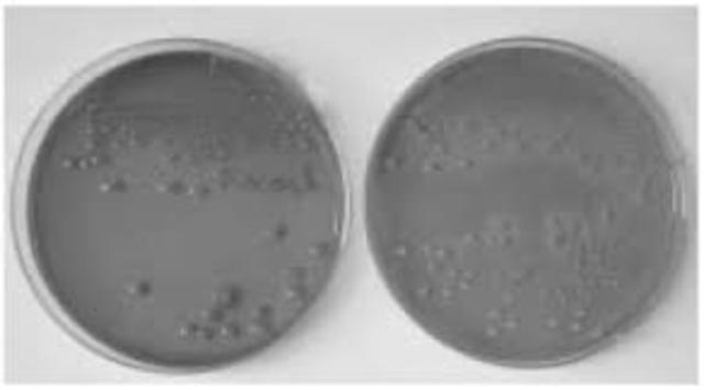 Como obtener cultivos puros sobre medio solido