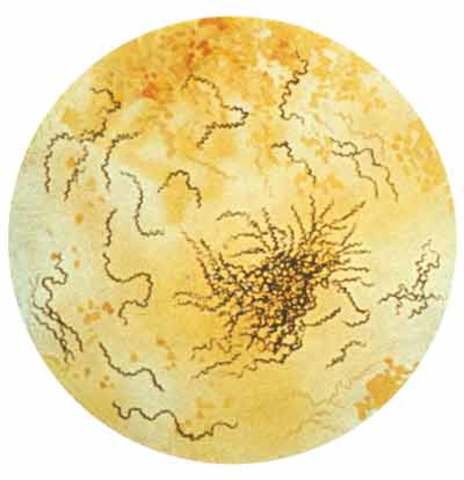 Agente productor de la sifilis