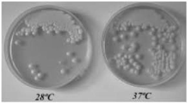 Como obtener cultivos puros sobre medio solido