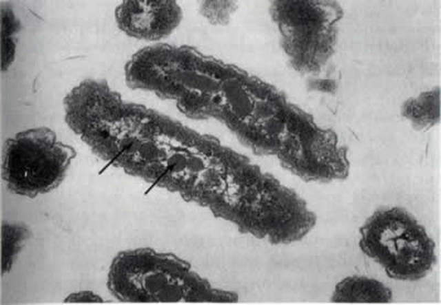 Serguéi Winogradski