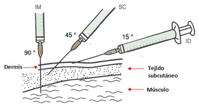 técnicas de vacunación.
