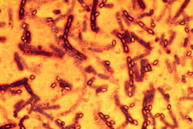 C. Davaine - BACTERIAS CAUSANTES DE ENFERMEDADES