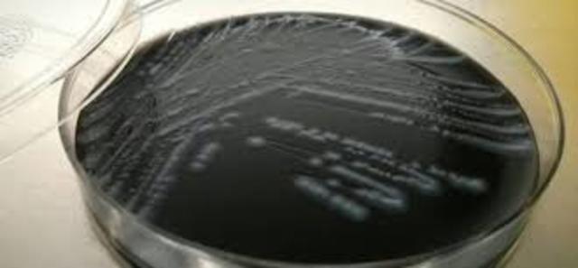 genoma de Legionella pneumophila,