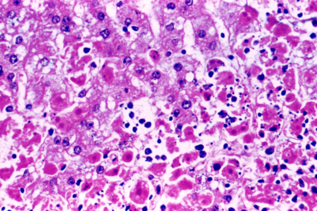 Ebola Vaccines Head to Human Trials