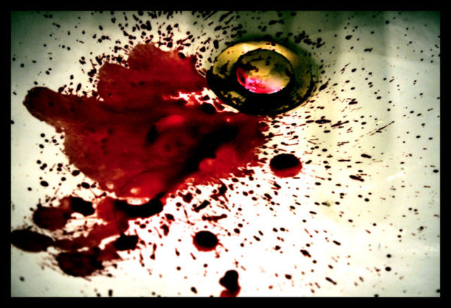 His mother ELizabith dies of Tuberculosis. Mrs. and Mr john Allan adpot Edgar