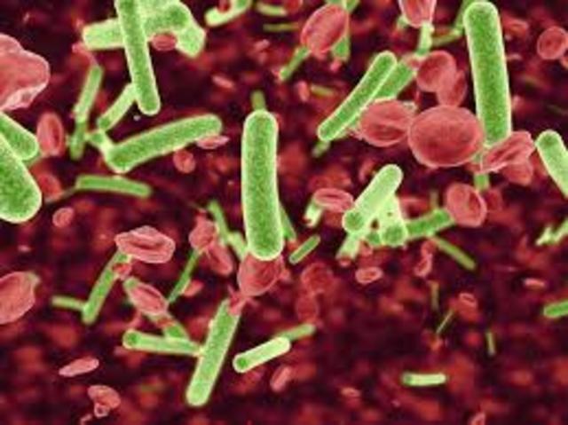 Los microorganismos (Anton Van Leeuwenhoek )