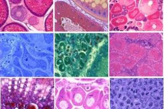 Comparacion de tejidos