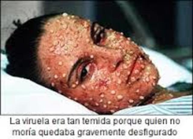 vacuna contra la viruela (edward genner)