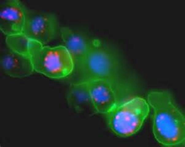 La Teoria Microbiana