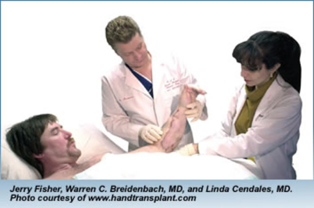 Invencion del primer implante de mano