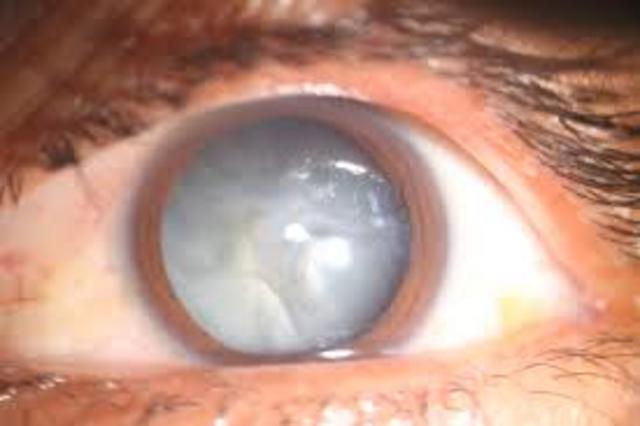 ANTIGUEDAD Y EDAD MEDIA