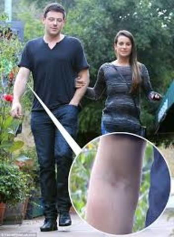 He will go in a clinic reavilitation