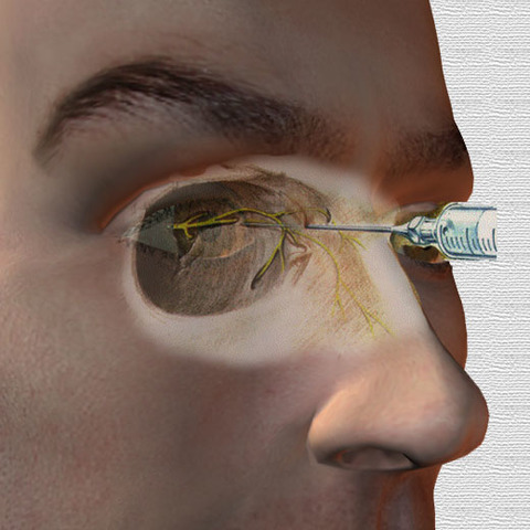 Anestesia oftálmica