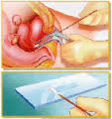 INICIOS DE LA CITOLOGIA