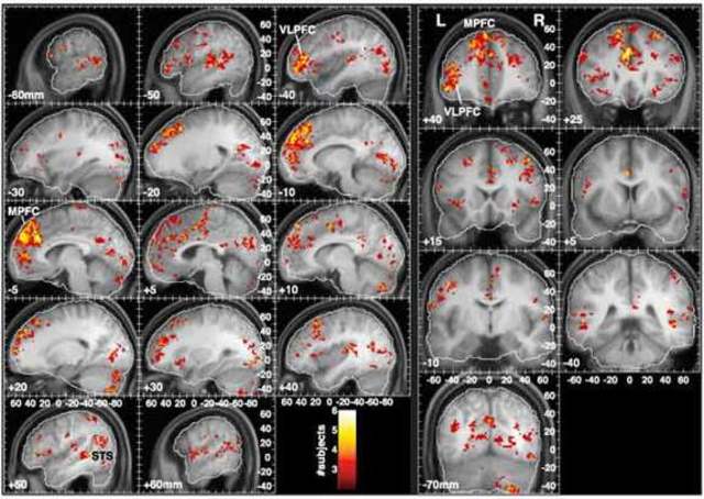 Music-Memory Connection Found in Brain