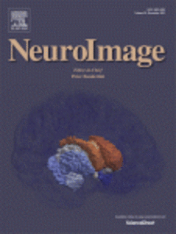 From Vivaldi to Beatles and Back: Predicting Lateralized Brain Respsones to Music