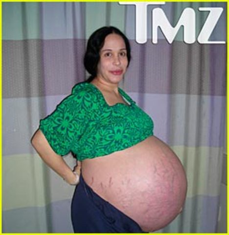 3 Nadya Suleman - mother of Octuplets (International)