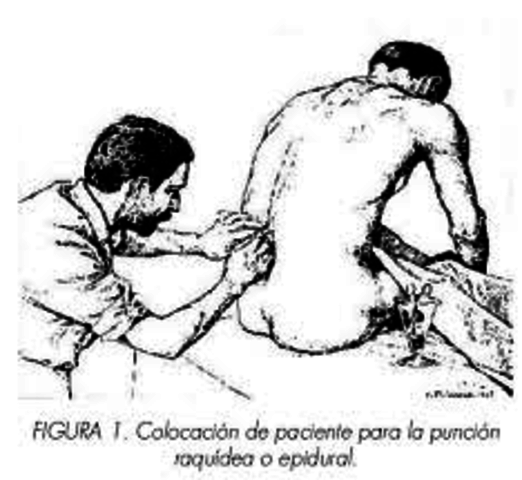 primera raquianestesia