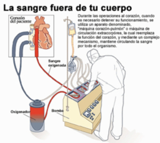 Primera maquina de circulación extracorporea