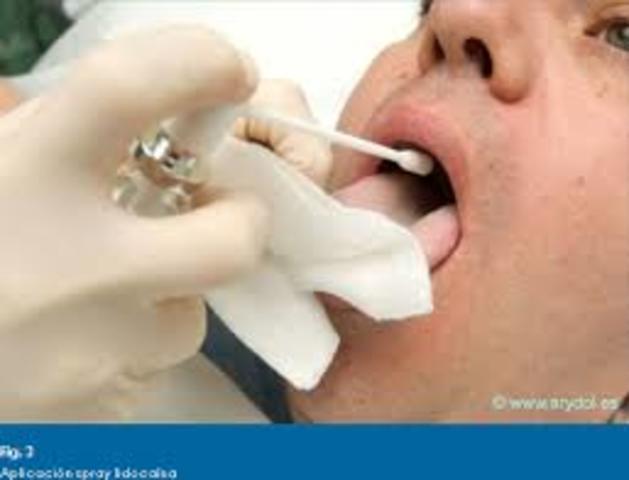 Anestesia topica