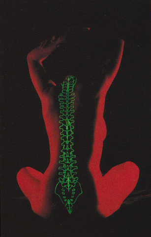 Descovered I have scoliosis