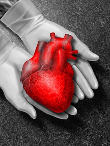 Primer transplante de corazón