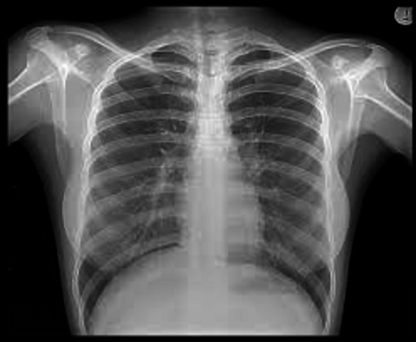 Dislocated my shoulder!