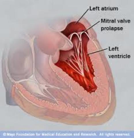 The Left Half Of The Heart: Lungs