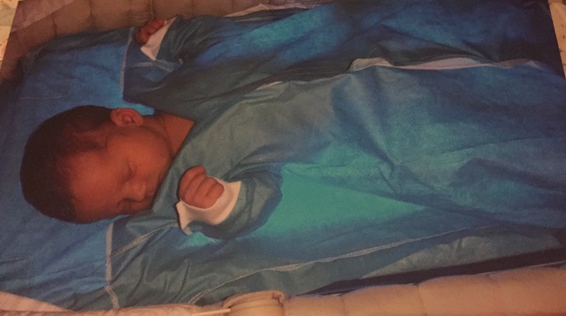 I had Jaundice When I was a Baby