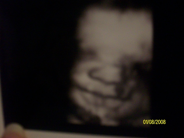 When I found out I was pregnant with Markel