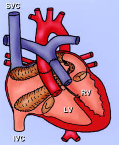 Superior and Inferior Vena Cava
