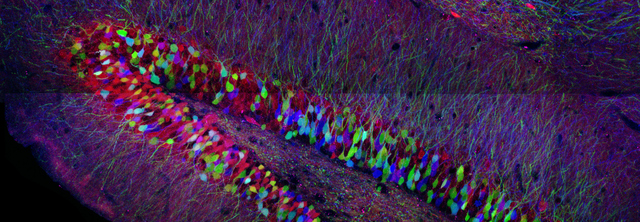 Proteínas Fluorescentes