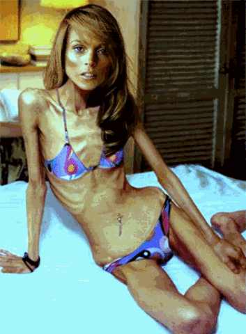 se estudian los aspectos de la anorexia