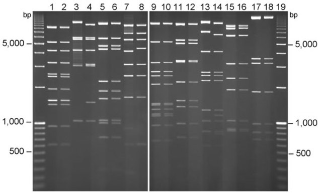Restriction Enzyme Analysis ( of DNA)