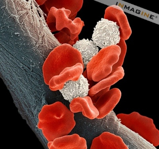 19th Century Leukaemia