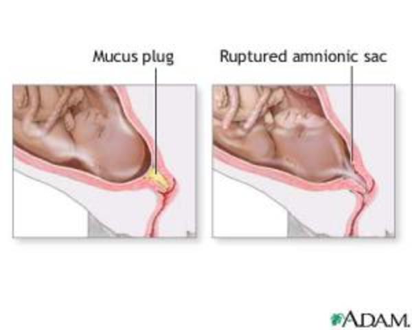 Early Signs of Labor