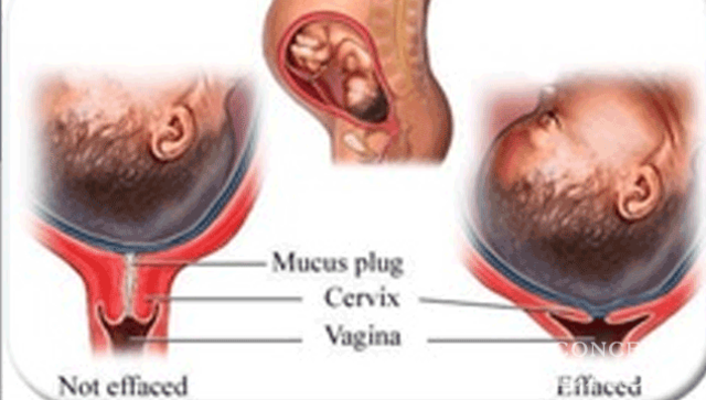 early signs of labor