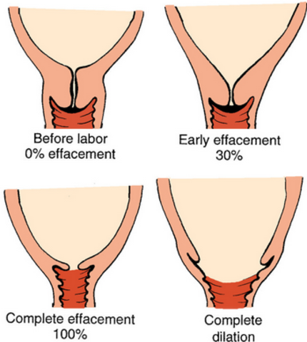 Stages of labor- first stage
