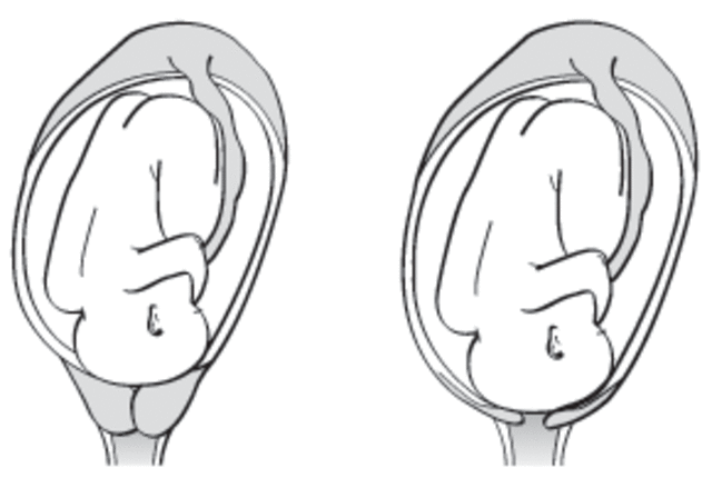 The first stage of labor