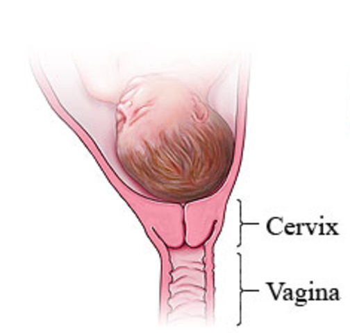 Early Signs of Labor