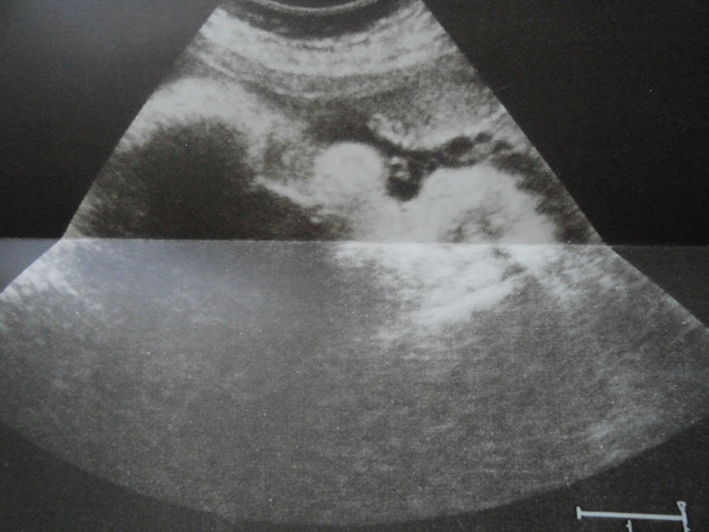 Хорошая новость