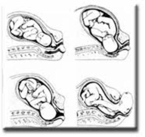 The second stage of Labor