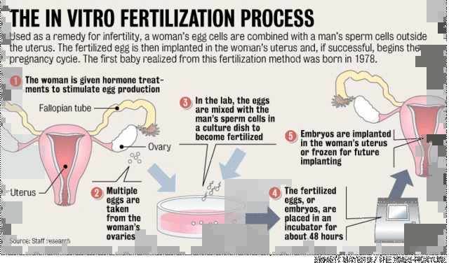 first in-vitro baby born