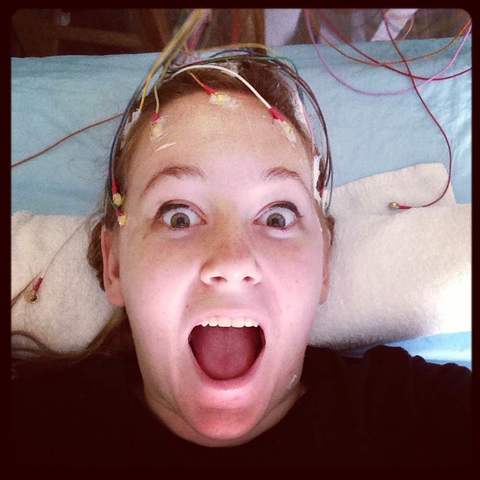 Diagnosis of Epilepsy